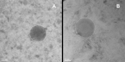 Imagens de crio-microscopia eletrônica de transmissão de um nanohidrogel. Fonte: European Journal of Pharmaceutics and Biopharmaceutics. (2018) 127, 244-249. DOI: 10.1016/j.ejpb.2018.02.015.